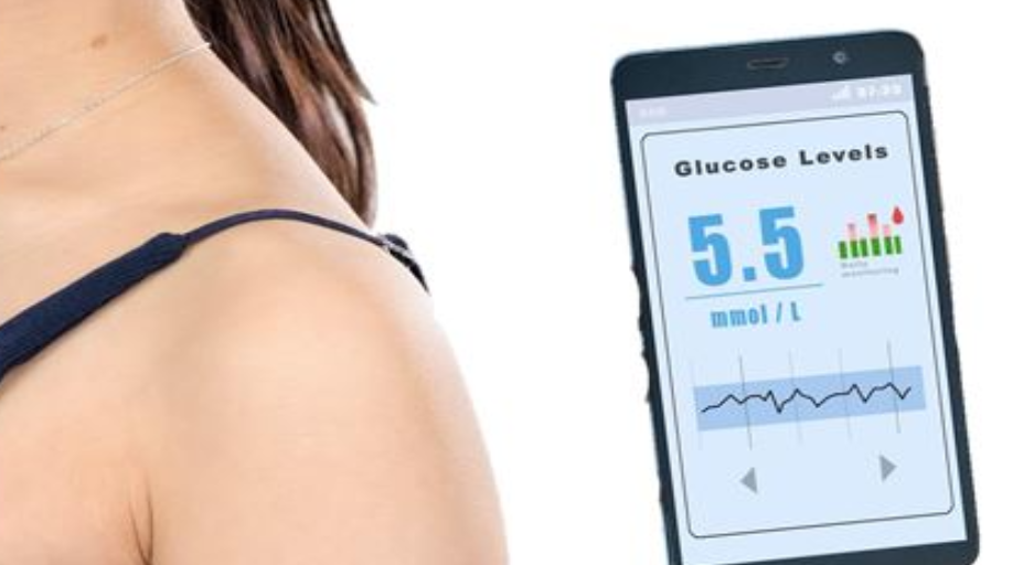 CGM SYSTEM